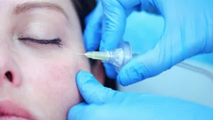 zabieg karboksyterapii