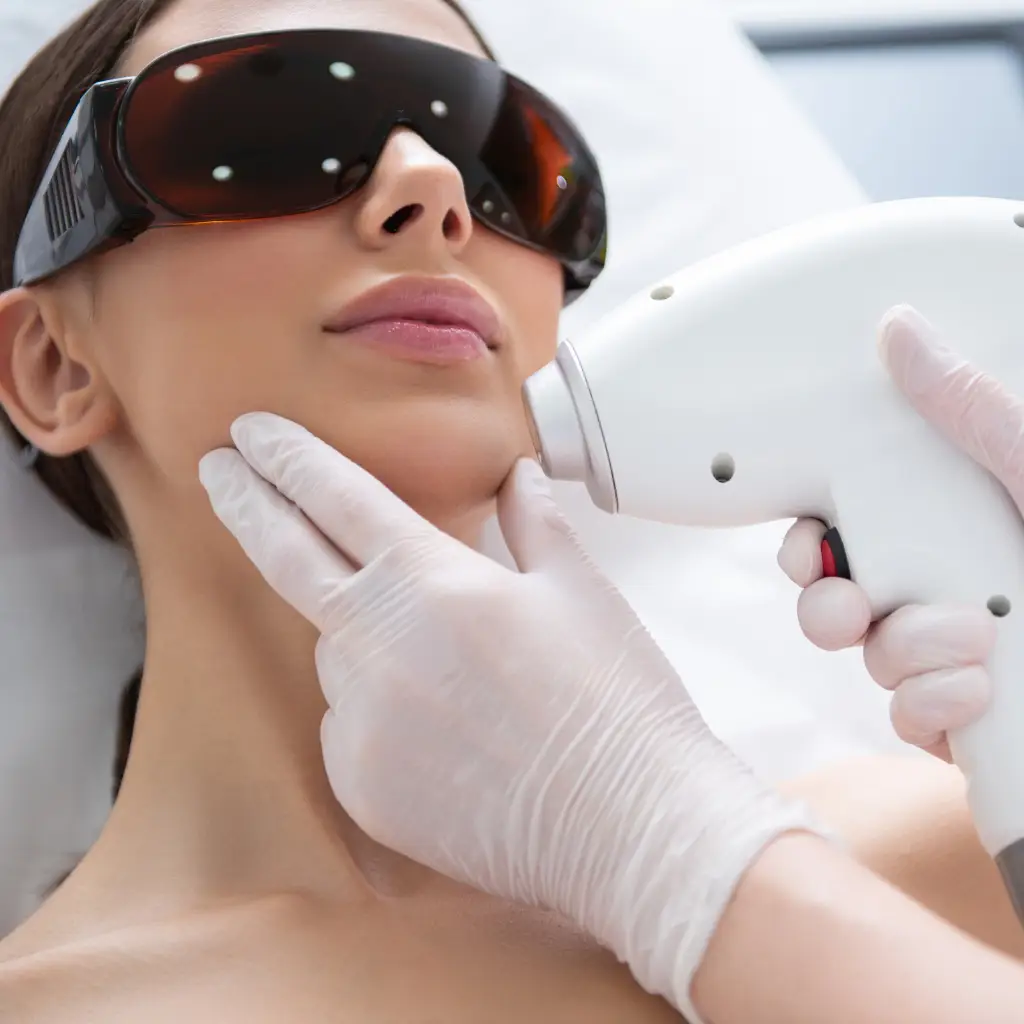 Depilacja laserowa brody kobiety