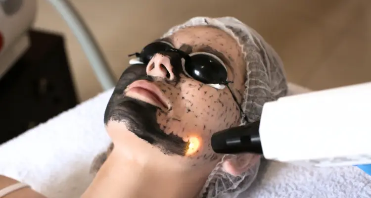 Read more about the article Dobroczynne efekty peelingu węglowego. Jak odzyskać równowagę skóry i naturalny efekt glow?